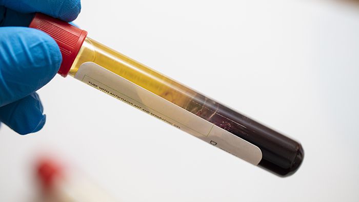 How to Maintain PRP Equipment Compliance